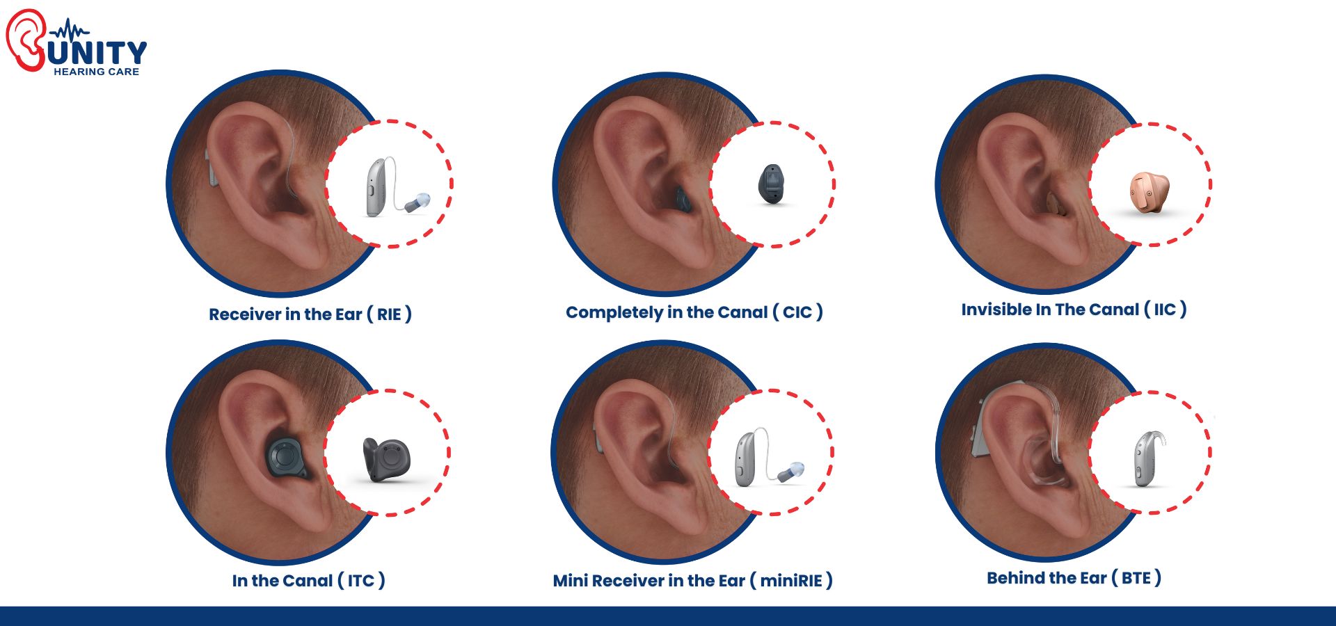 Various types of hearing aids worn in the ear – RIE, CIC, IIC, ITC, miniRIE, BTE by Unity Hearing Care